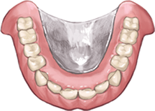 総入れ歯